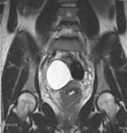 MRI画像 骨盤のイメージ