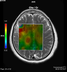 MRI画像 頭部のイメージ1
