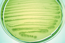 緑膿菌 緑色の色素を産生するのが特徴です