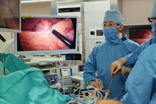 腹腔鏡手術写真2