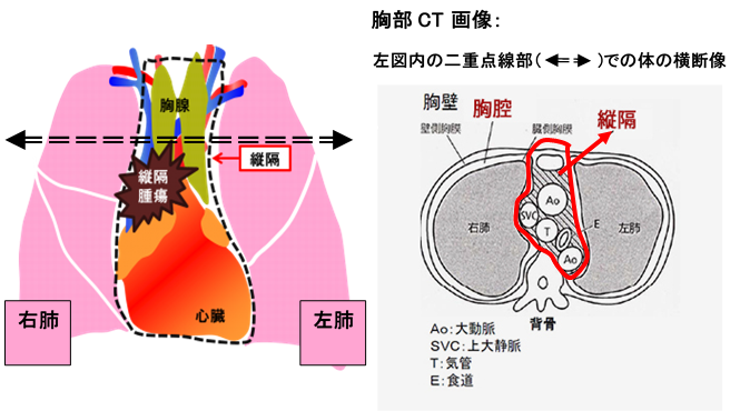 縦隔の図